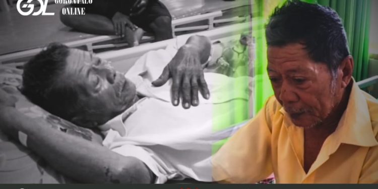 Seorang Kakek di Pohuwato Jadi Korban Penganiayaan Oknum Kades